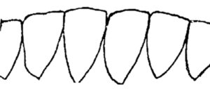 Sheep Teeth